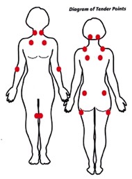 Tender Points Chart